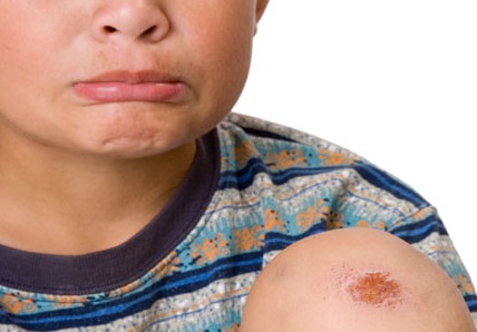 accident-skinned-knee.jpg